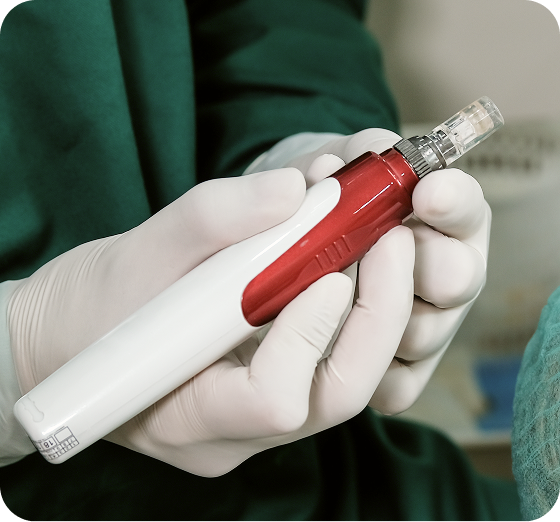 Provider preparing microneedling with PRF device for Bio-CARE treatment.